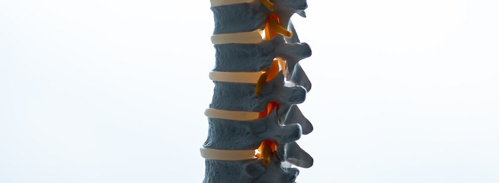 College Park AICA spine vertebrae model