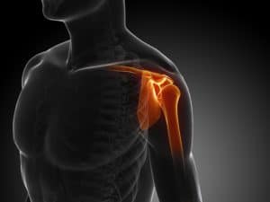 Everything You Need To Know About Shoulder Dislocations | AICA Orthopedics