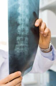 What kind of doctor helps with spinal issues - feat image