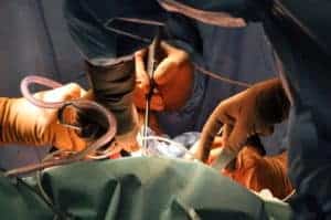 What Is the Success Rate for Minimally Invasive Spine Surgery?