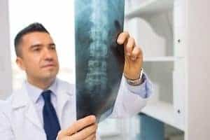 Spine doctor looking at x-ray of spine - what kind of doctor helps with spinal issues blog - AICA