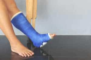 An Easier Recovery From Ankle Fractures | AICA Orthopedics