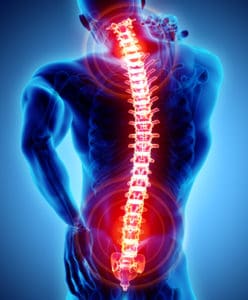 Which Parts of the Spine are Most Vulnerable in an Accident