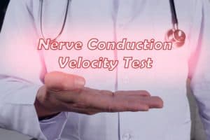 what-to-expect-from-a-nerve-conduction-velocity-ncv-test