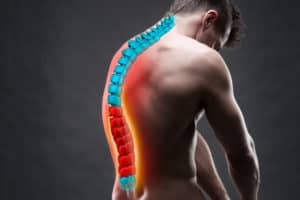 How to Heal a Herniated Disc Naturally