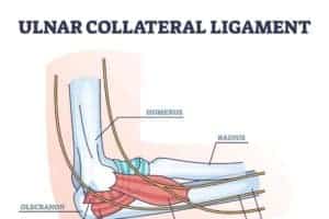 Ulnar Collateral Ligament Tears