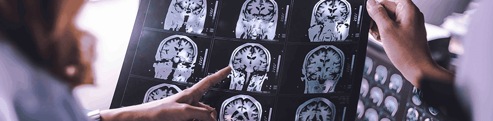 traumatic brain injury